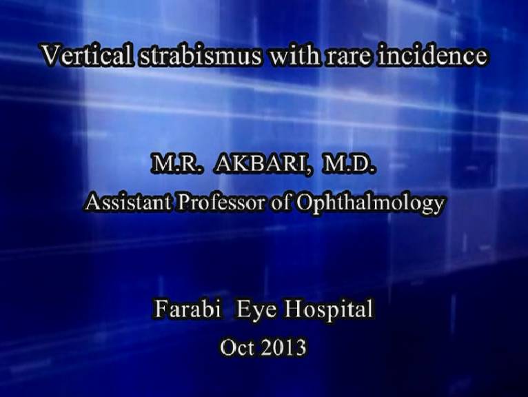 نفر دوم جشنواره - Vertical sterabismus with rare incidance